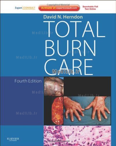 Total Burn Care E-Book
