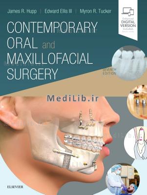 Contemporary Oral and Maxillofacial Surgery (7th edition)