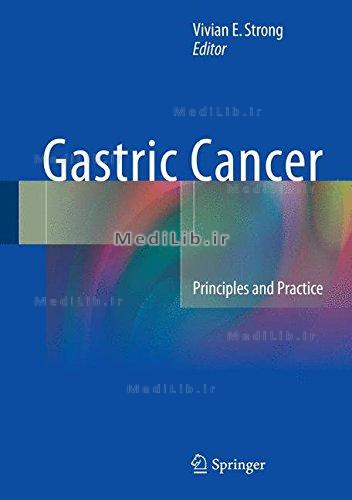 Gastric Cancer