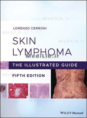Skin Lymphoma: The Illustrated Guide