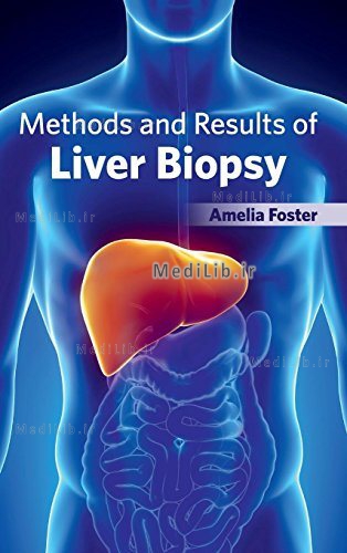 Methods and Results of Liver Biopsy