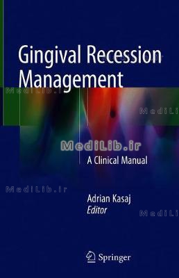 Gingival Recession Management: A Clinical Manual