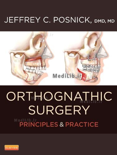 Orthognathic Surgery
