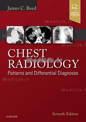 Chest Radiology: Patterns and Differential Diagnoses (7th Revised edition)