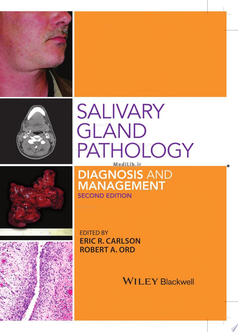 Salivary Gland Pathology