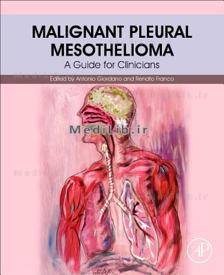 Malignant Pleural Mesothelioma: A Guide for Clinicians