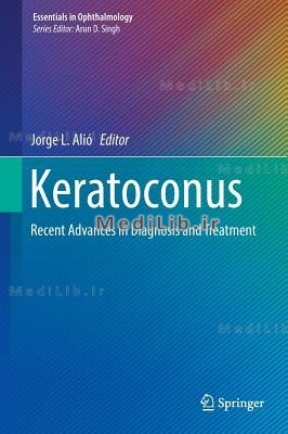 Keratoconus