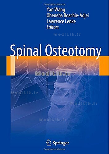 Spinal Osteotomy