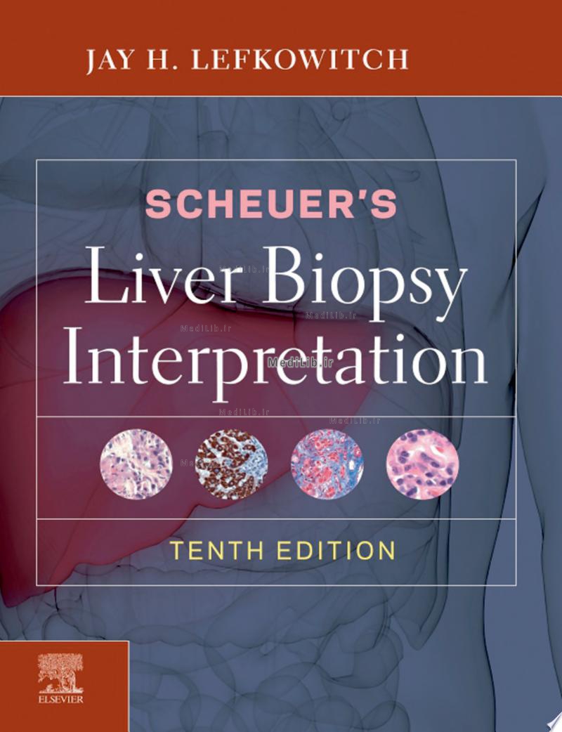 Scheuer's Liver Biopsy Interpretation E-Book