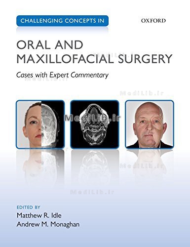 Challenging Concepts in Oral and Maxillofacial Surgery