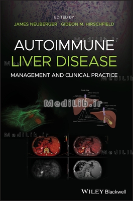 Autoimmune Liver Disease: Management and Clinical Practice