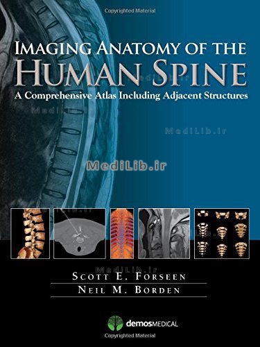 Imaging Anatomy of the Human Spine