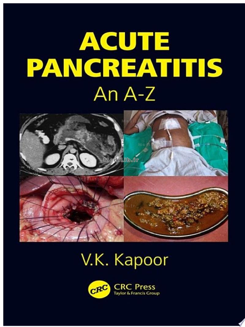 Acute Pancreatitis