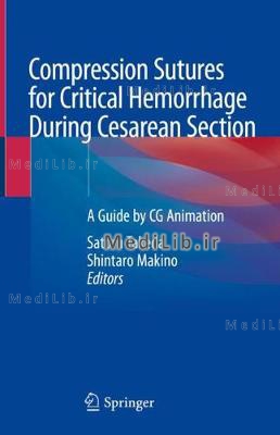 Compression Sutures for Critical Hemorrhage During Cesarean Section: A Guide by CG Animation (2020 e