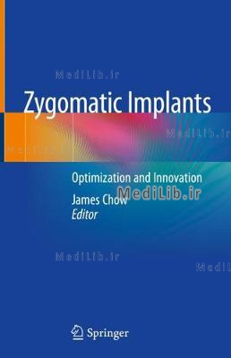 Zygomatic Implants: Optimization and Innovation (2020 edition)