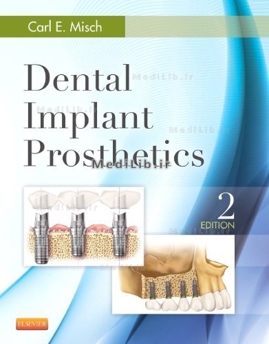Dental Implant Prosthetics