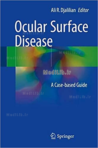 Ocular Surface Disease