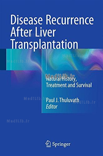 Disease Recurrence After Liver Transplantation
