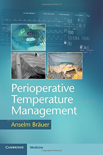 Perioperative Temperature Management