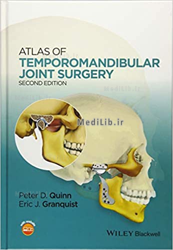Atlas of Temporomandibular Joint Surgery