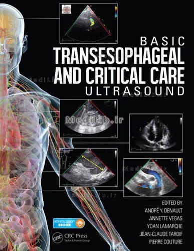 Basic Transesophageal and Critical Care Ultrasound