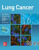 Lung Cancer: Standards of Care
