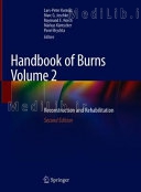 Handbook of Burns Volume 2