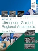 Atlas of Ultrasound-Guided Regional Anesthesia