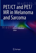 PET/CT and PET/MR in Melanoma and Sarcoma