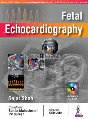 Fetal Echocardiography