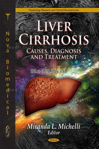 Liver Cirrhosis