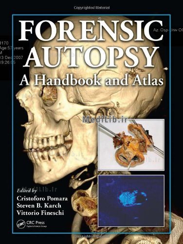 Forensic Autopsy