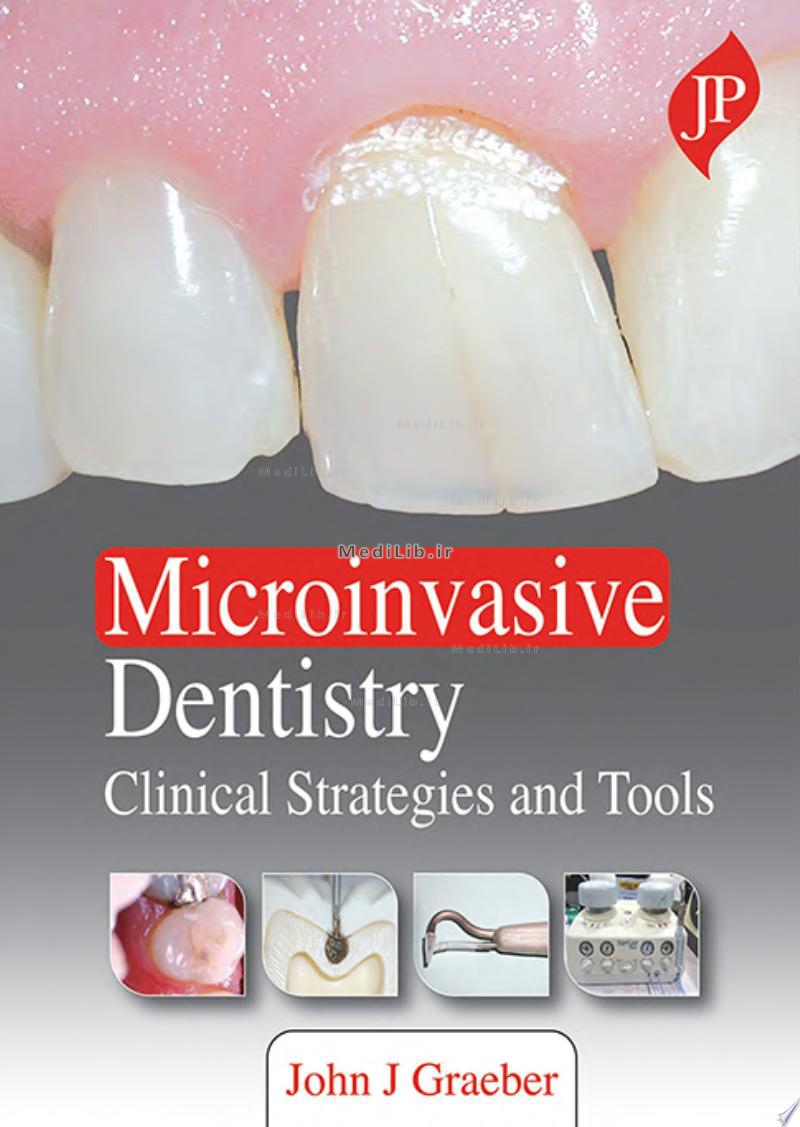 Microinvasive Dentistry
