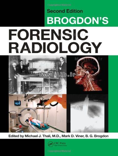 Brogdon's Forensic Radiology, Second Edition