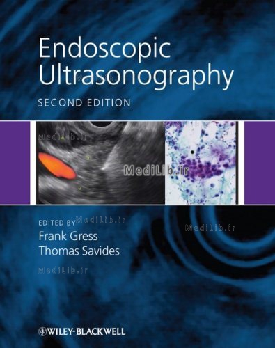 Endoscopic Ultrasonography