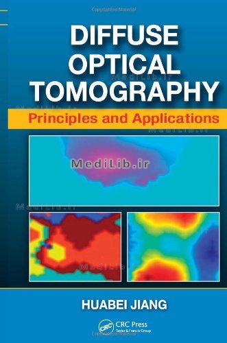 Diffuse Optical Tomography