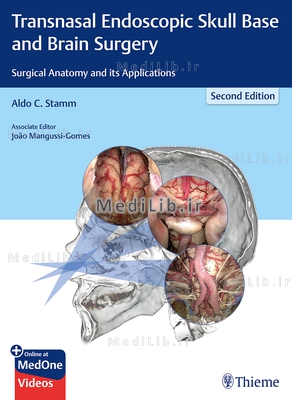 Transnasal Endoscopic Skull Base and Brain Surgery: Surgical Anatomy and Its Applications (2nd editi