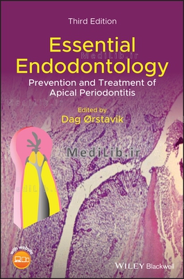 Essential Endodontology: Prevention and Treatment of Apical Periodontitis (3rd Edition)