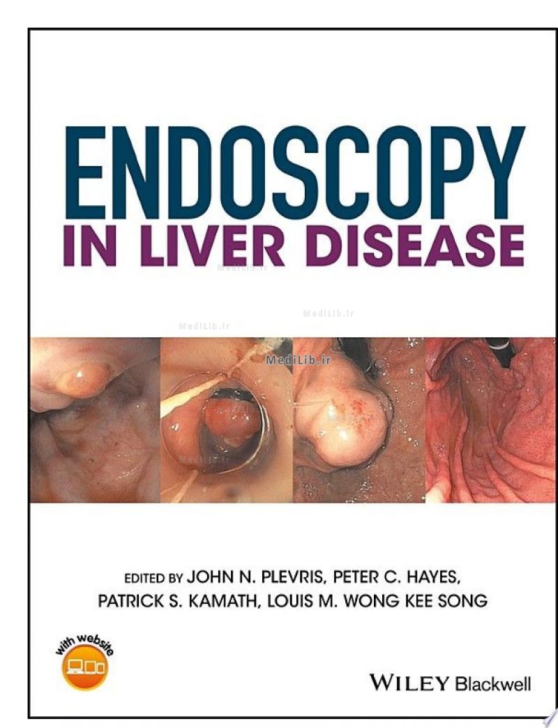 Endoscopy in Liver Disease
