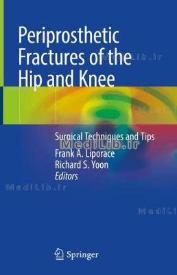 Periprosthetic Fractures of the Hip and Knee: Surgical Techniques and Tips (2019 edition)