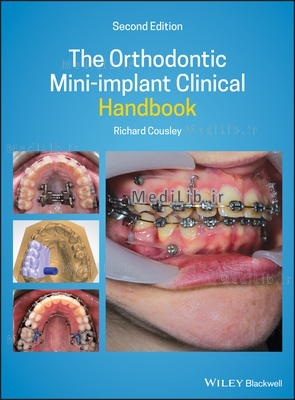 The Orthodontic Mini-implant Clinical Handbook (2nd Edition)