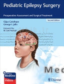 Pediatric Epilepsy Surgery