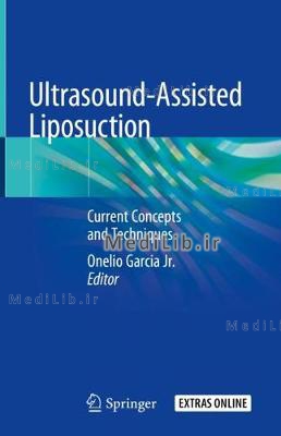 Ultrasound-Assisted Liposuction: Current Concepts and Techniques (2020 edition)