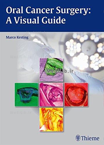 Oral Cancer Surgery: A Visual Guide