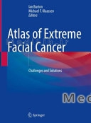 Atlas of Extreme Facial Cancer