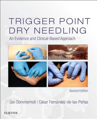 Trigger Point Dry Needling: An Evidence and Clinical-Based Approach (2nd edition)