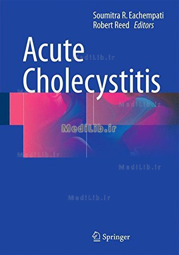 Acute Cholecystitis