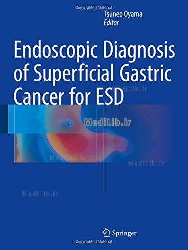 Endoscopic Diagnosis of Esophageal Carcinoma for ESD
