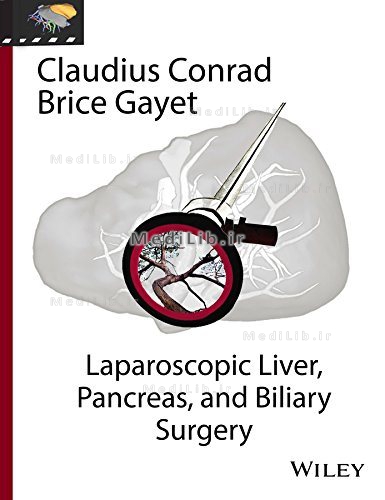 Laparoscopic Liver, Pancreas, and Biliary Surgery, Textbook and Illustrated Video Atlas