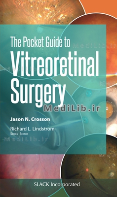 The Pocket Guide to Vitreoretinal Surgery